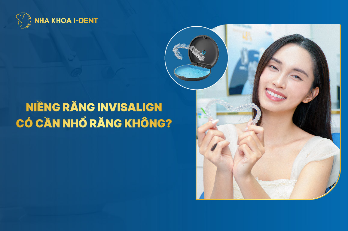 Niềng răng invisalign có cần nhổ răng không?