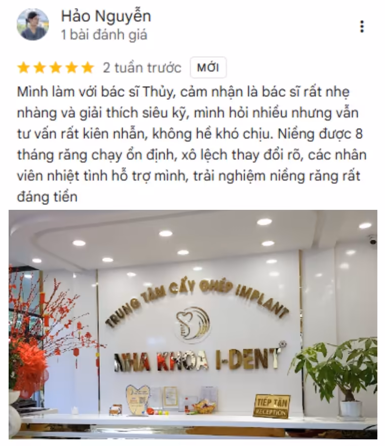 review niềng răng mắc cài nha khoa ident