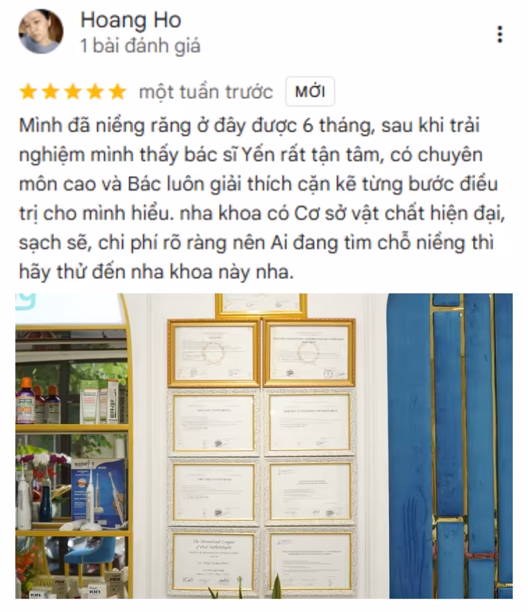 Review niềng răng mắc cài