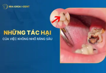 tác hại của việc không nhổ răng sâu