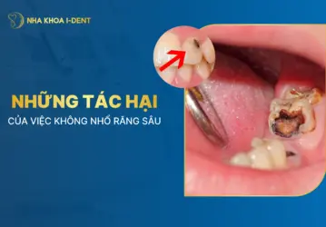 tác hại của việc không nhổ răng sâu