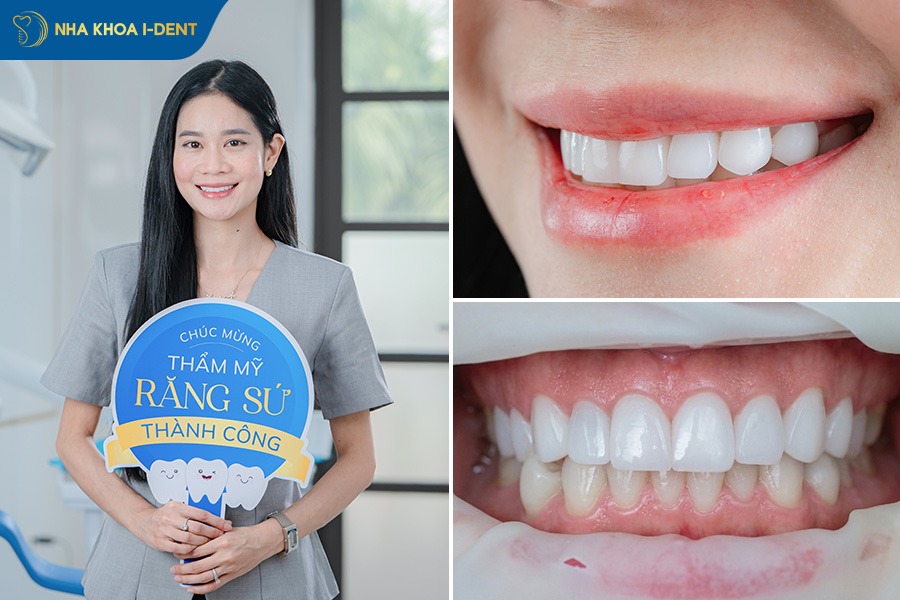Thúy Vy - Khách hàng răng sứ