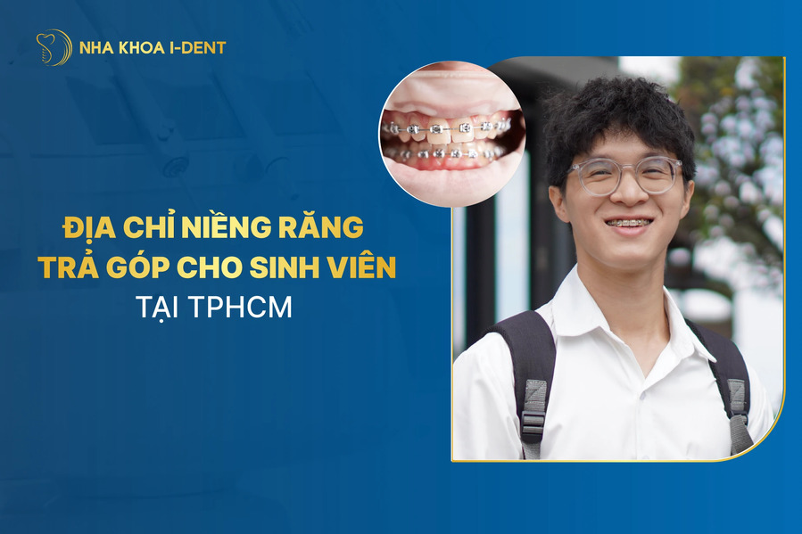 niềng răng giá sinh viên