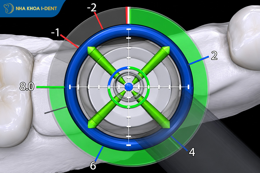 x-guide dynamic 3d navigation