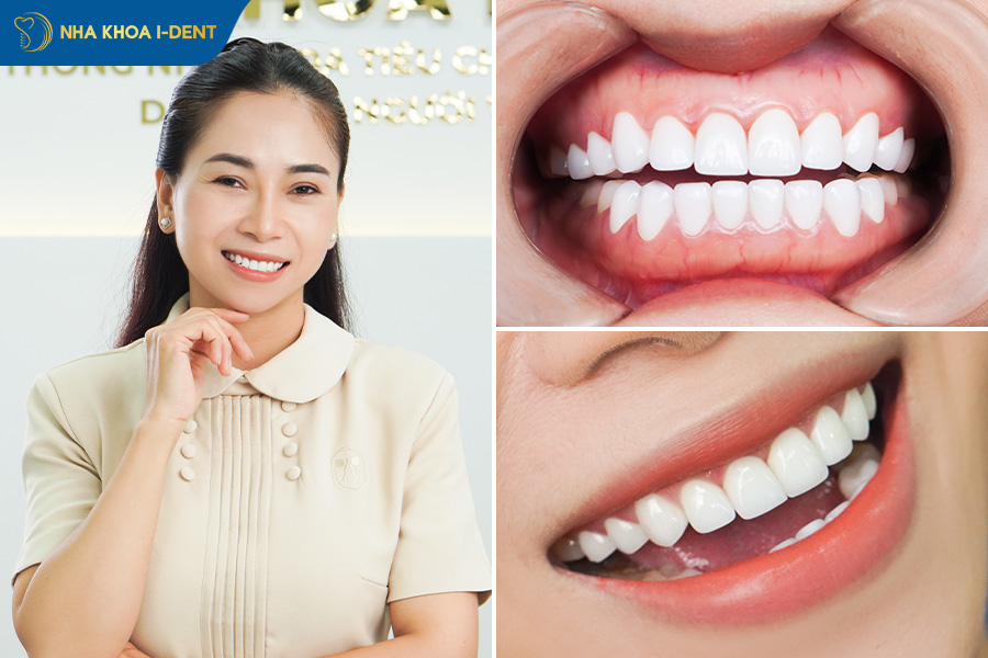 bảng giá răng sứ