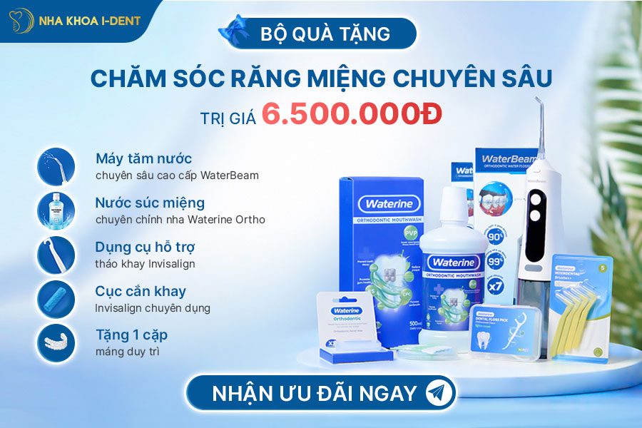 bảng giá niềng răng