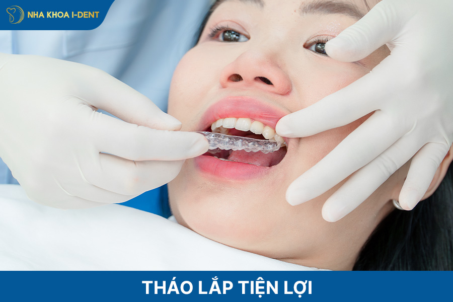 đeo khay invisalign