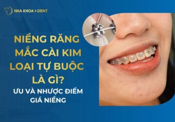mắc cài kim loại tự buộc