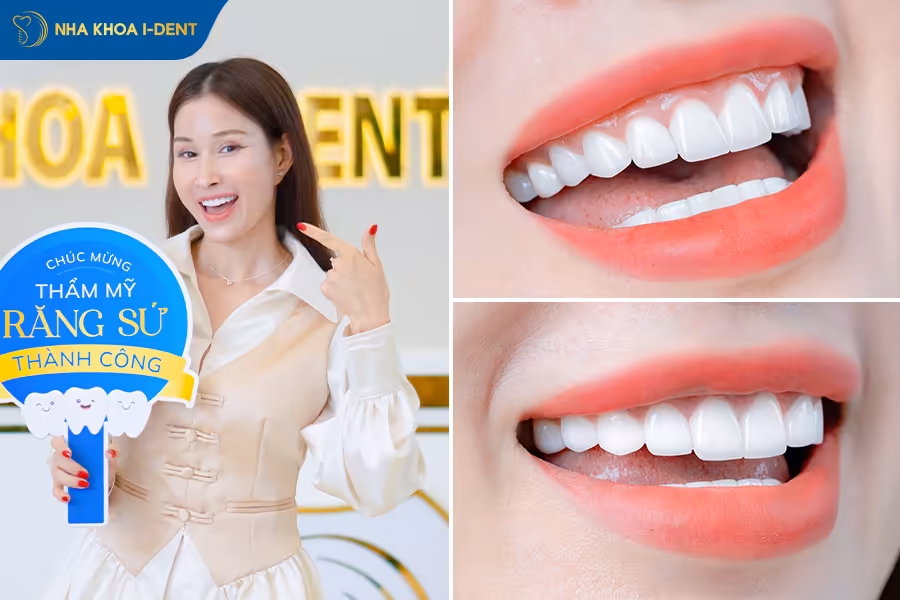 khách hàng làm răng sứ thẩm mỹ