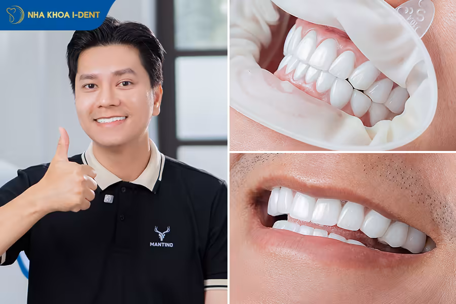 khách hàng làm răng sứ