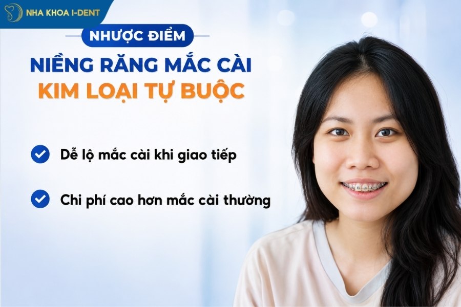 mắc cài kim loại tự đóng