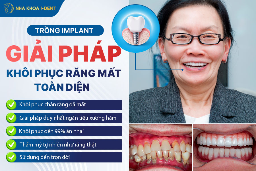 mất nguyên chân răng trồng được không