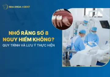 nhổ răng số 8