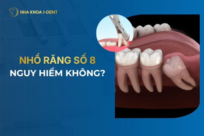 nhổ răng số 8 có nguy hiểm không