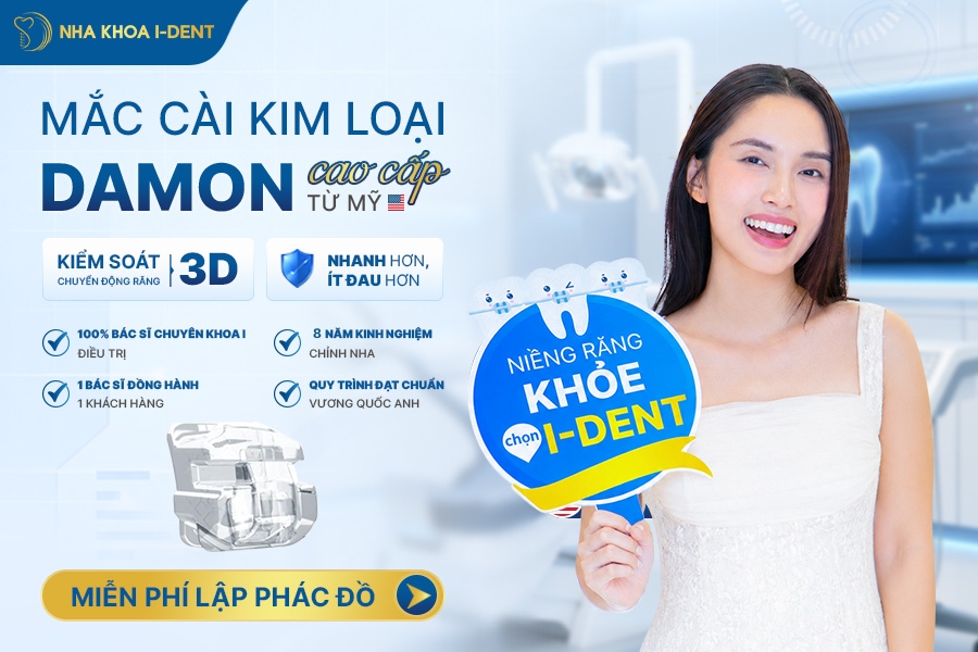Niềng răng mắc cài kim loại Damon cao cấp từ Mỹ đạt hiệu quả chỉnh nha cao