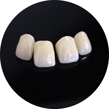 Răng sứ toàn sứ Bio Esthetic