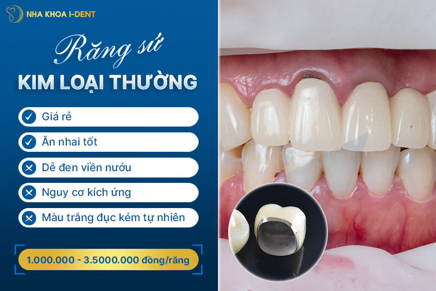 răng sứ 