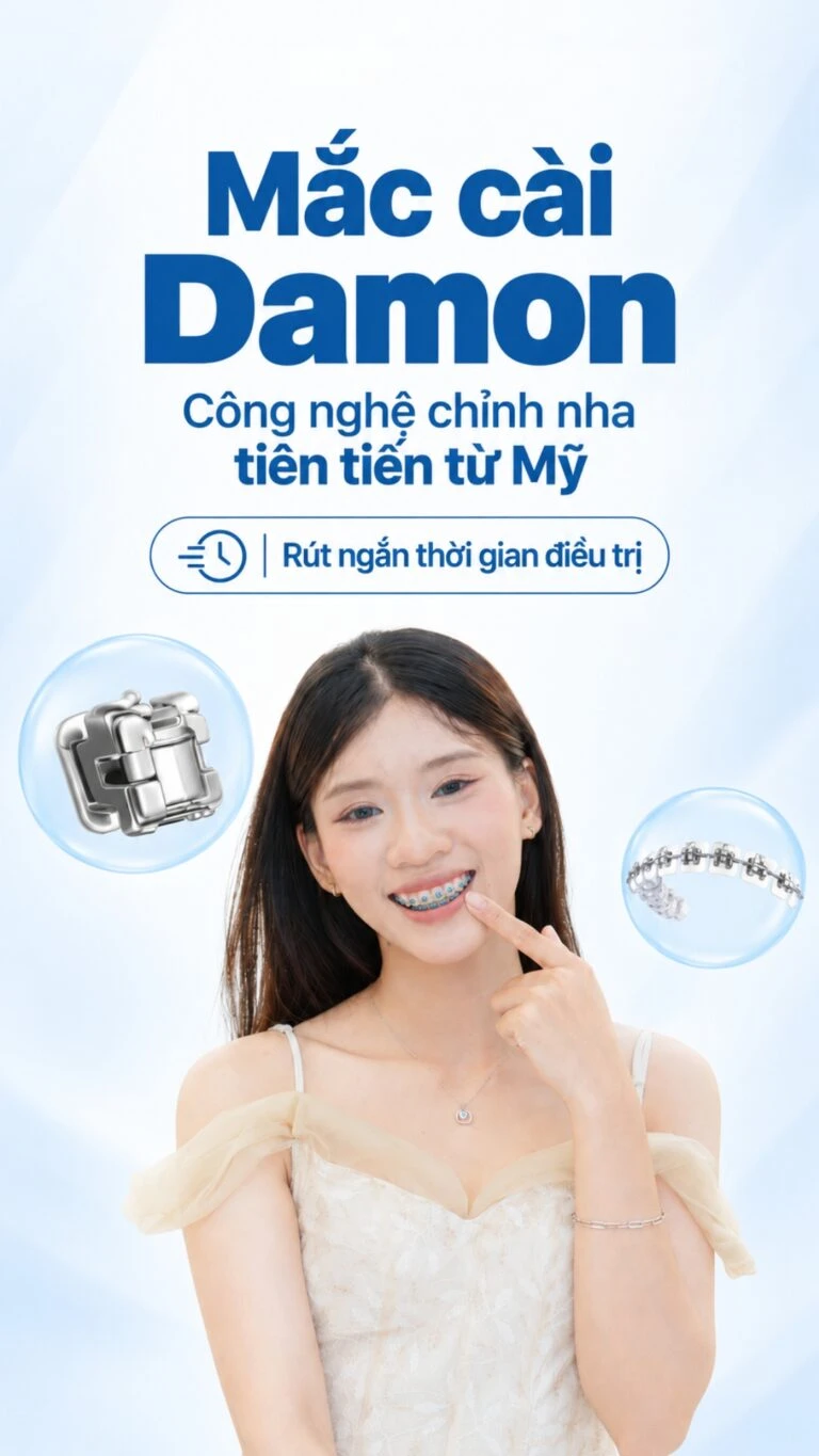 Niềng răng mắc cài Damon tại Nha khoa I-Dent