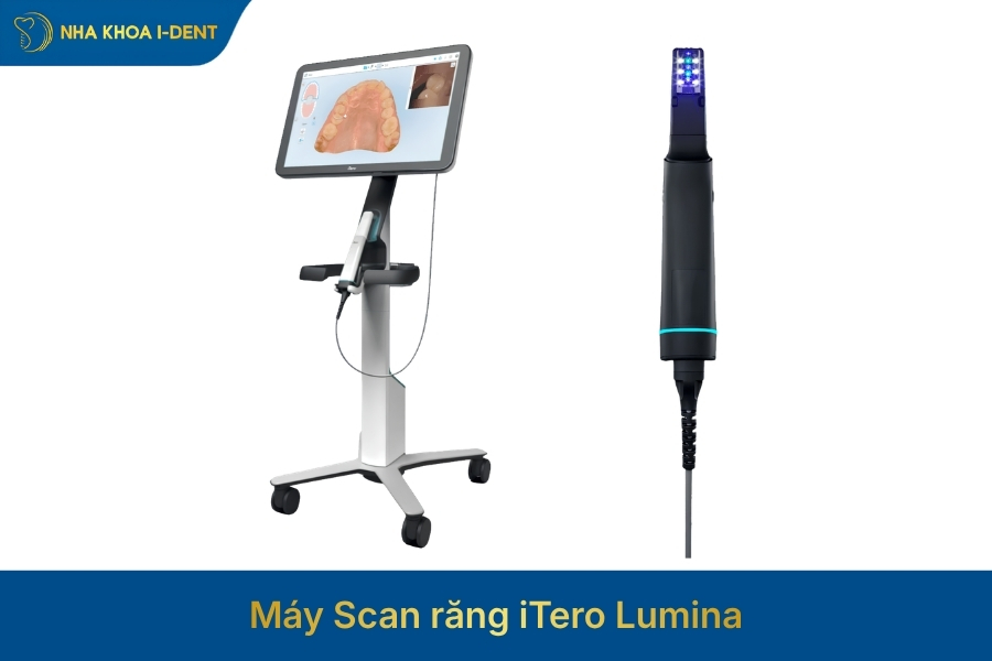 máy scan itero lumina