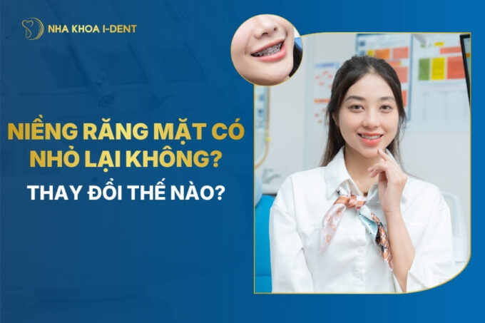 niềng răng mặt có nhỏ lại không