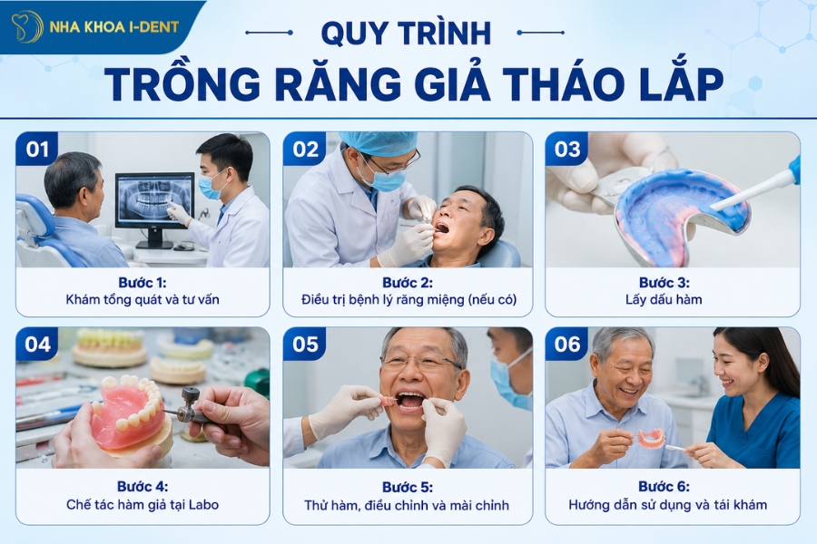 quy trình trồng răng tháo lắp