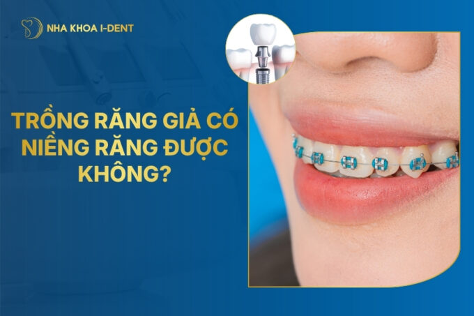 Trồng Răng Giả Có Niềng Được Không?