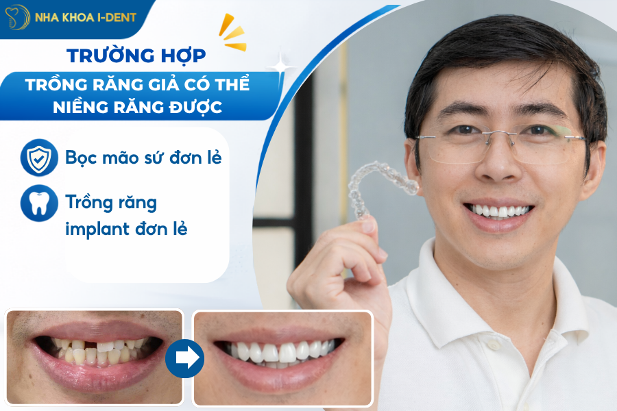 trồng răng có niềng được không