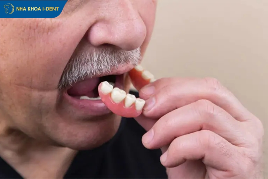 trồng răng tháo lắp là gì