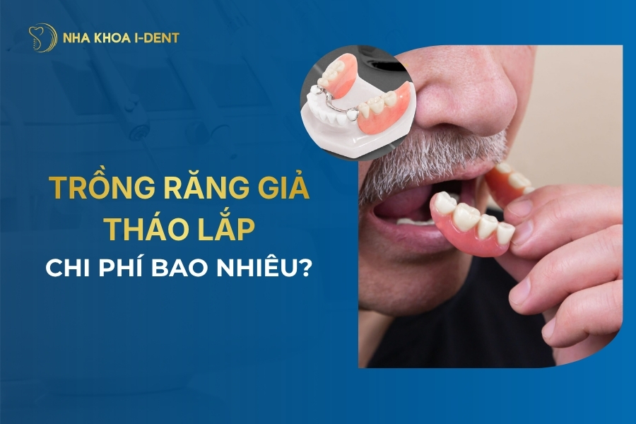 trồng răng tháo lắp