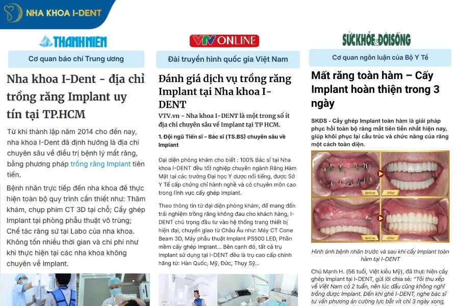 trồng răng implant giá bao nhiêu tiền