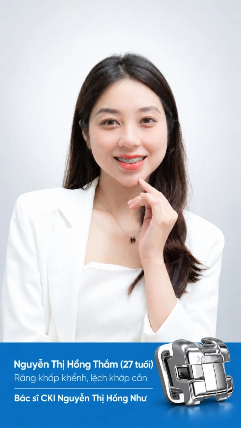 Khách hành niềng răng mắc cài tại Nha khoa I-Dent