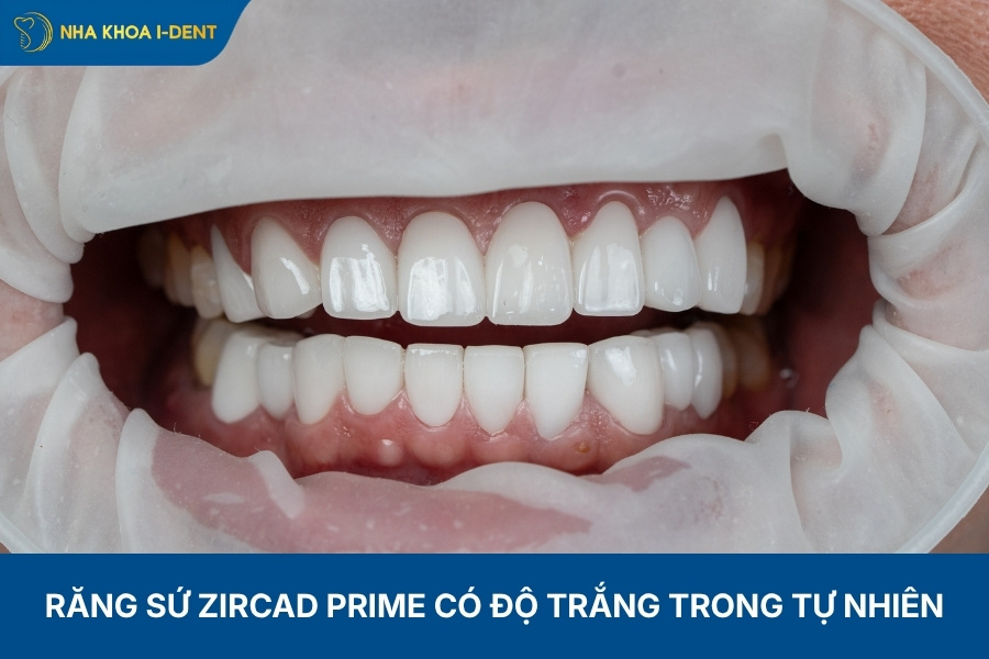 răng sứ emax zircad prime