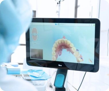 Máy iTero Lumina thế hệ mới tại Nha khoa I-Dent