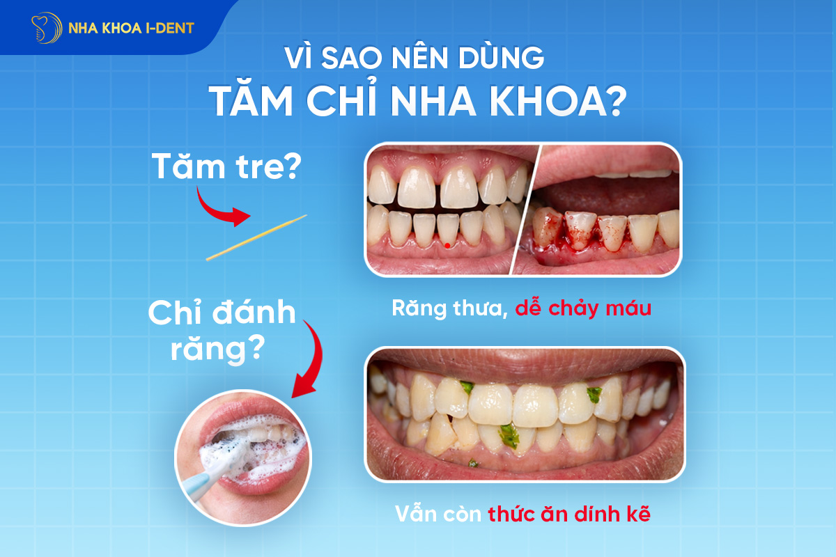 tăm chỉ waterine