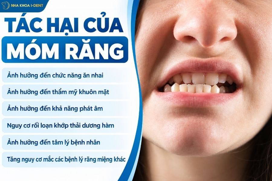 hàm răng móm - Nha khoa I-Dent