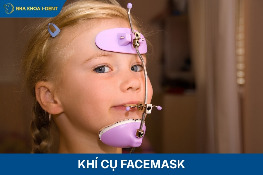 khớp cắn ngược nhẹ