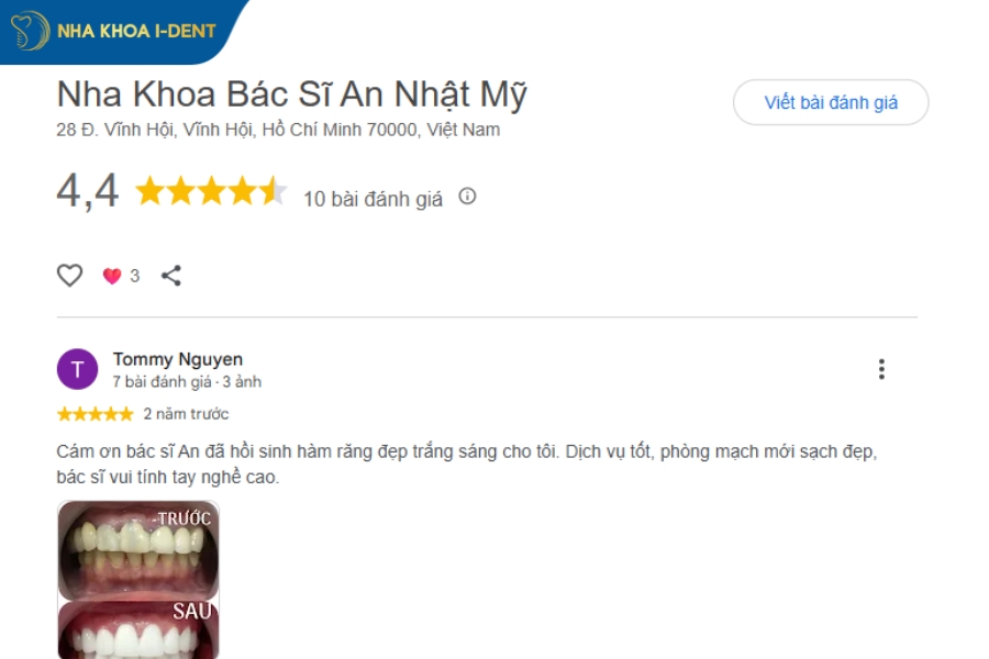 nha khoa quận 4 khám tổng quát
