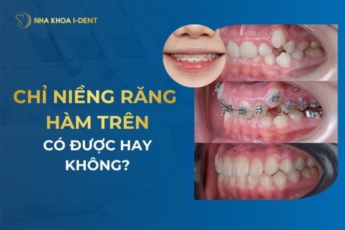 Răng mọc lệch: Các kiểu, Nguyên nhân, và cách khắc phục