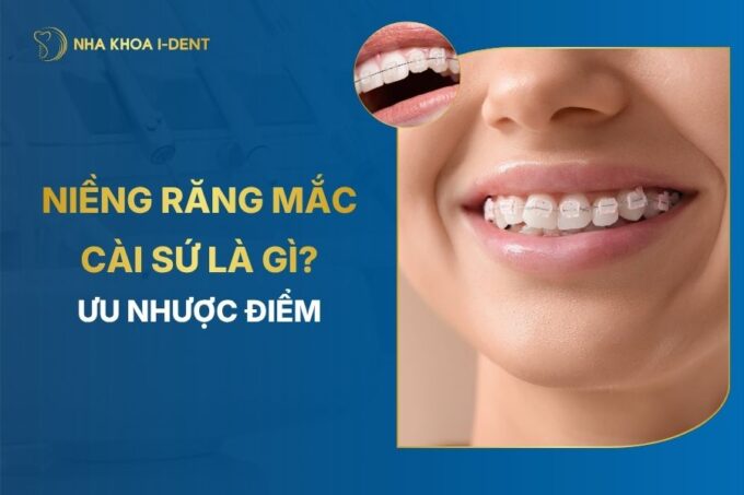Niềng Răng Mắc Cài Sứ Là Gì? Lợi Ích Và Ưu Nhược Điểm