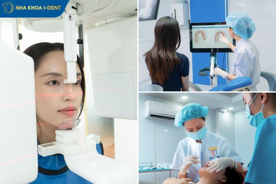 niềng răng phải nhổ răng có ảnh hưởng gì không