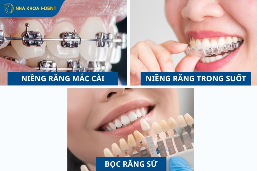 răng khểnh là gì