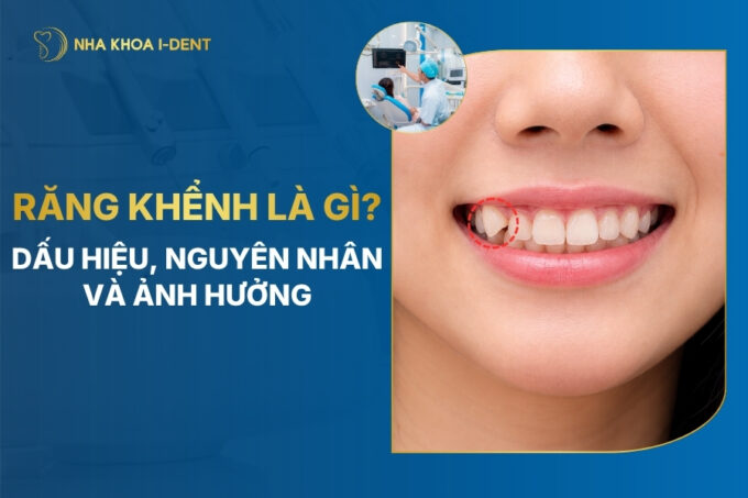 răng khểnh