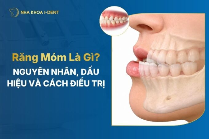 Răng Móm: Nguyên Nhân, Dấu Hiệu Và Cách Khắc Phục