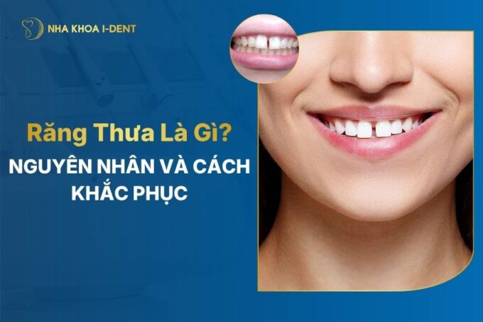 Răng Thưa Là Gì? Tại Sao Bị Răng Thưa? Cách Khắc Phục