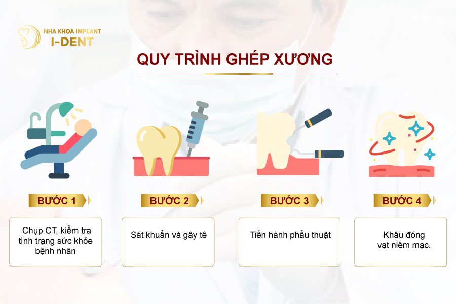 ghép xương răng