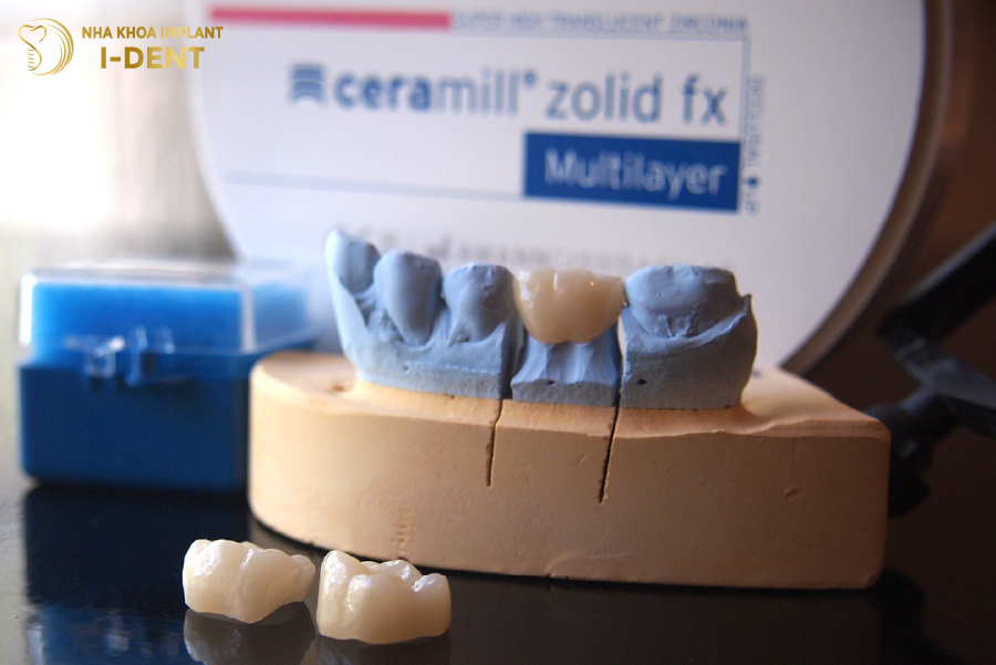 Răng sứ Ceramill Zolid Răng sứ Ceramill Zolid