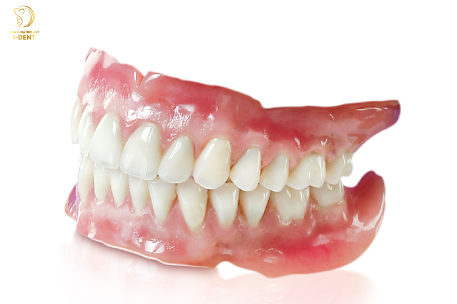 Phương pháp hàm tháo lắp giá trồng răng cấm