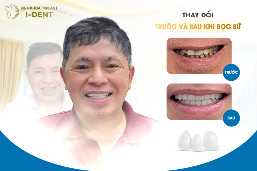 khách hàng sau khi bọc răng sứ tại Nha khoa I-DENT khách hàng sau khi bọc răng sứ tại Nha khoa I-DENT