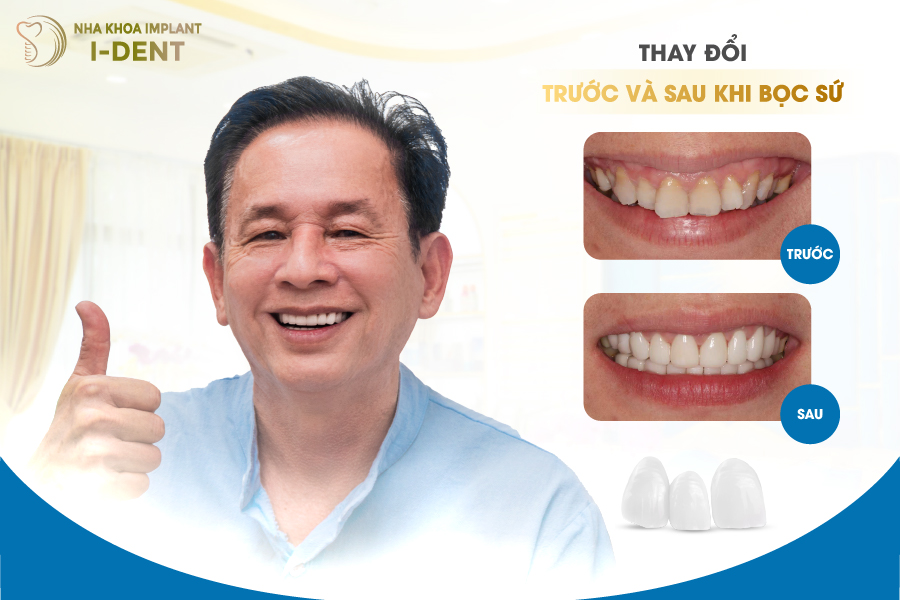 khách hàng sau khi bọc răng sứ tại Nha khoa I-DENT khách hàng sau khi bọc răng sứ tại Nha khoa I-DENT