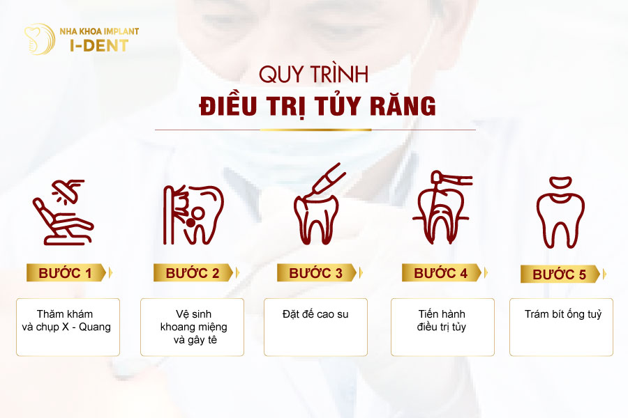 Quy trình lấy tủy cho trẻ tại Nha khoa I - DENT Quy trình lấy tủy cho trẻ tại Nha khoa I - DENT